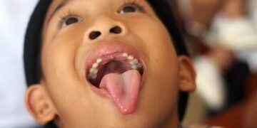 The Fluoride Question: Why Is It Still in Our Water?