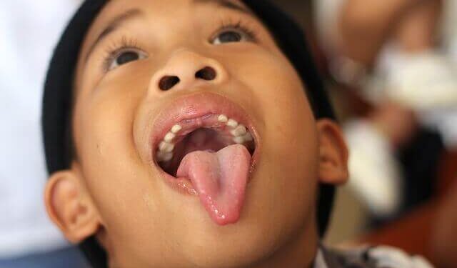 The Fluoride Question: Why Is It Still in Our Water?